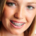 коррекция зубов